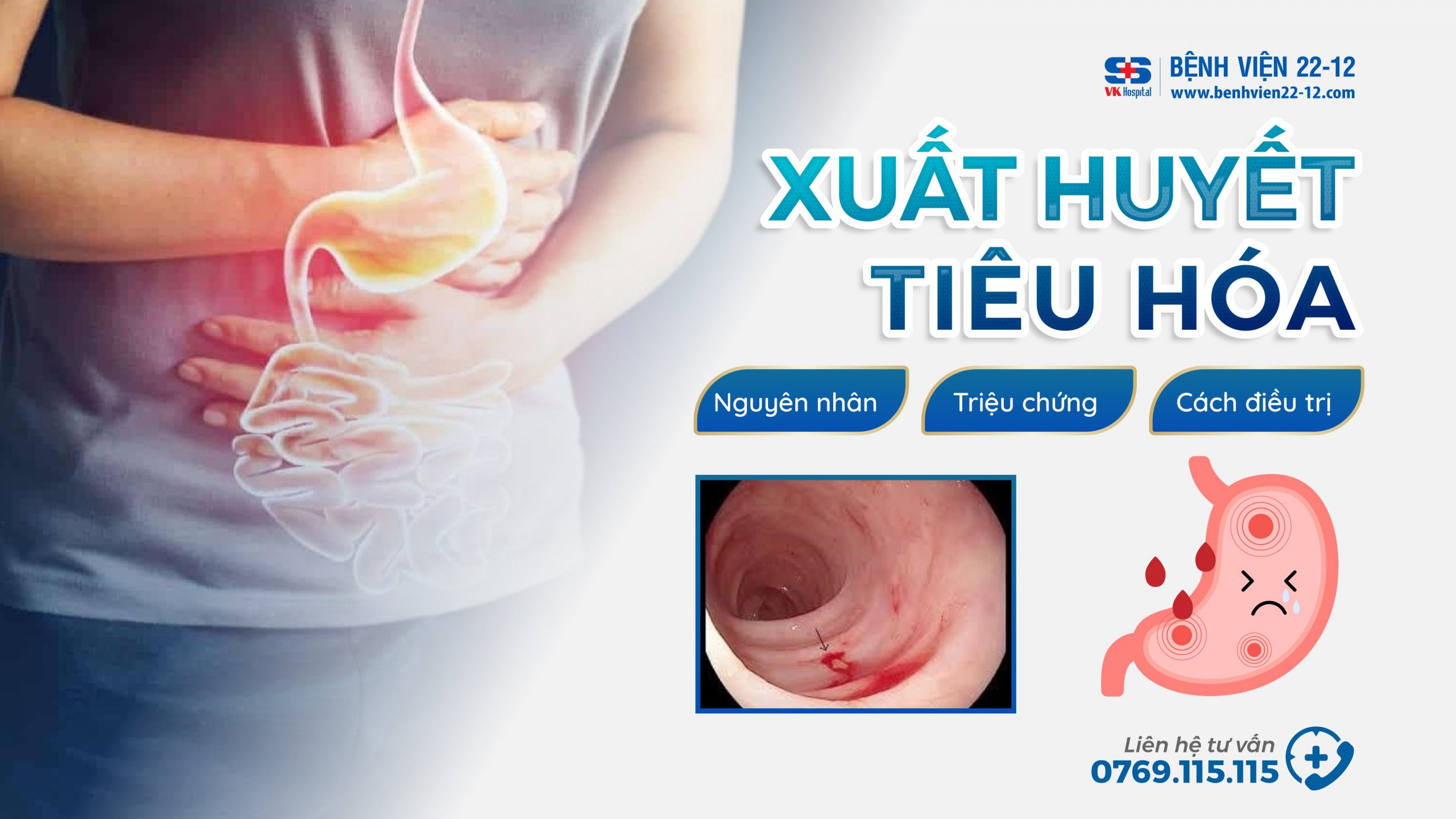 dấu hiệu xuất huyết tiêu hóa - Image 5
