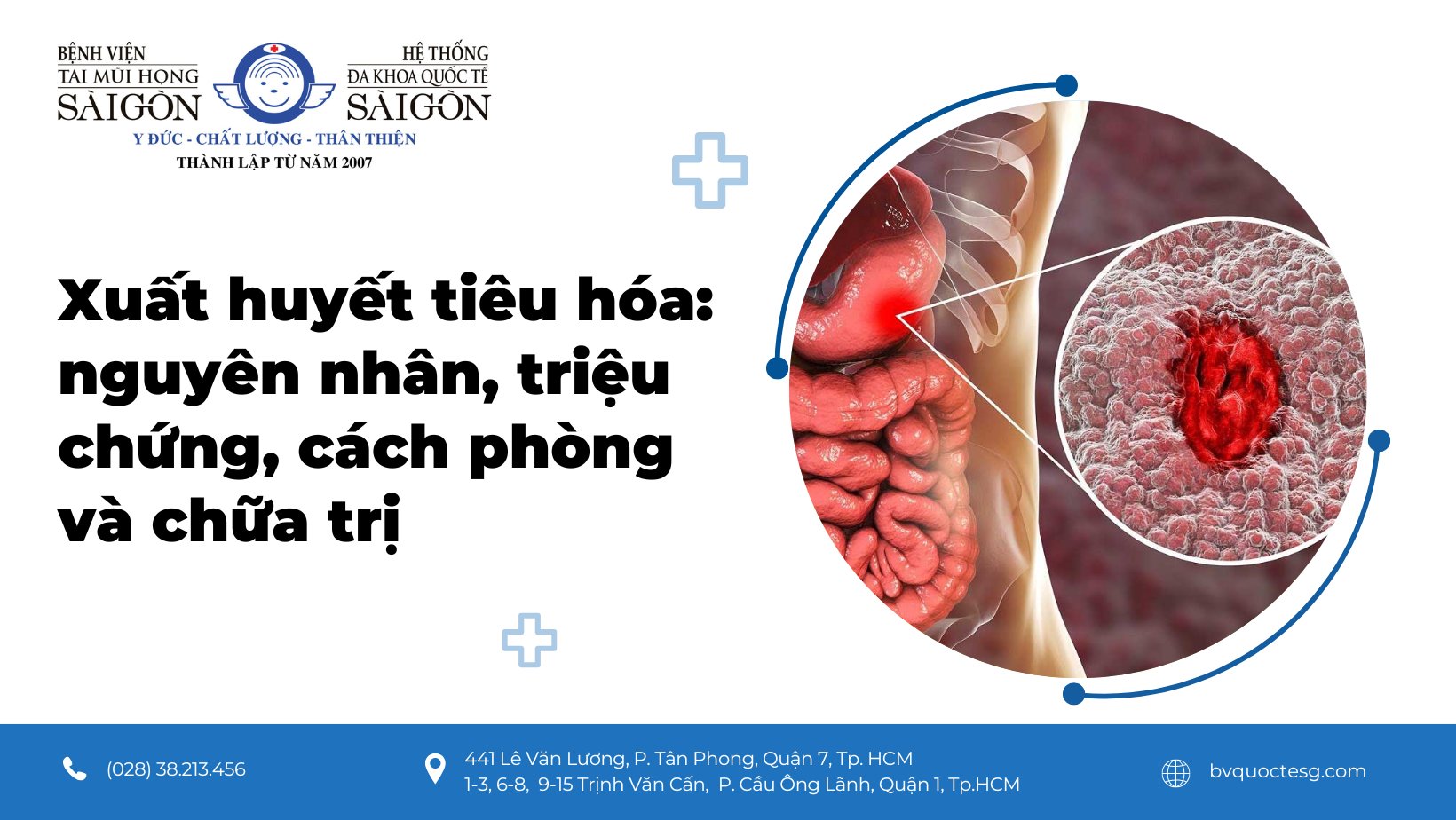 dấu hiệu xuất huyết tiêu hóa - Image 1
