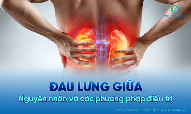 đau lưng giữa - Image 1