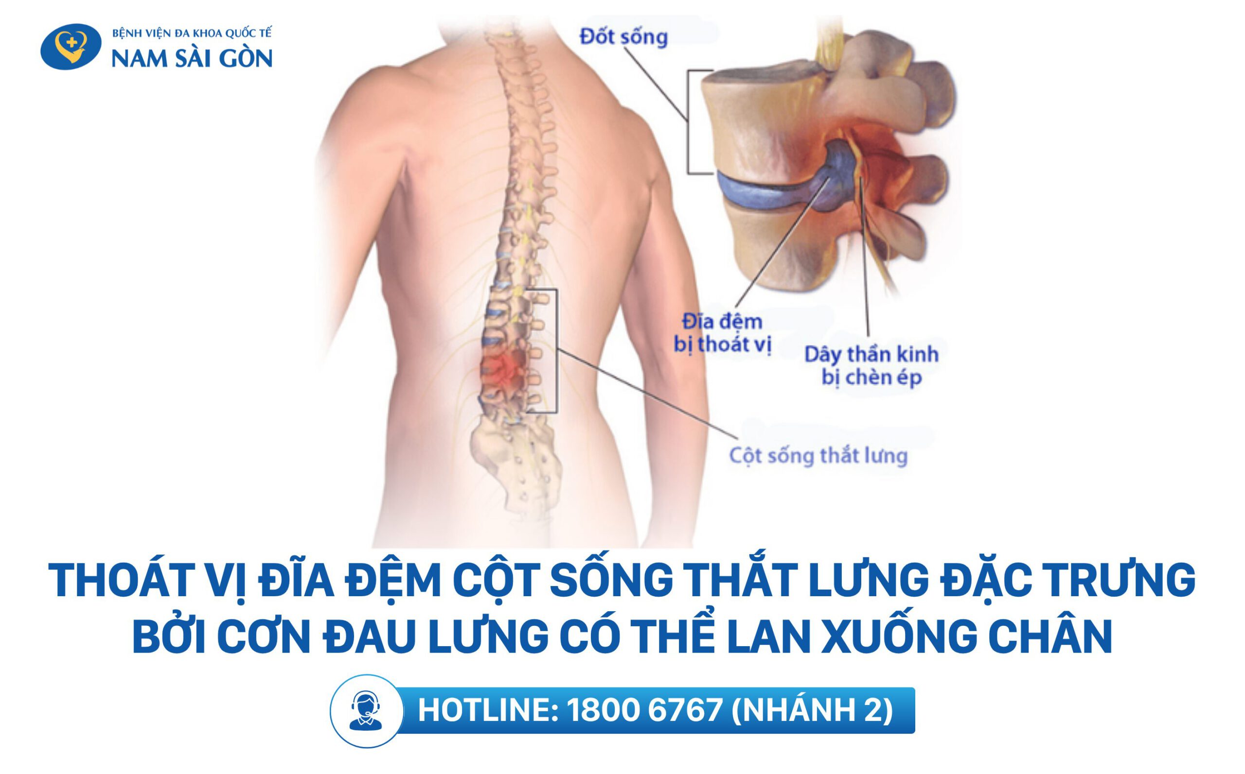 đau lưng là dấu hiệu bệnh gì - Image 4