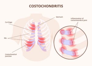 đau ngực bên phải