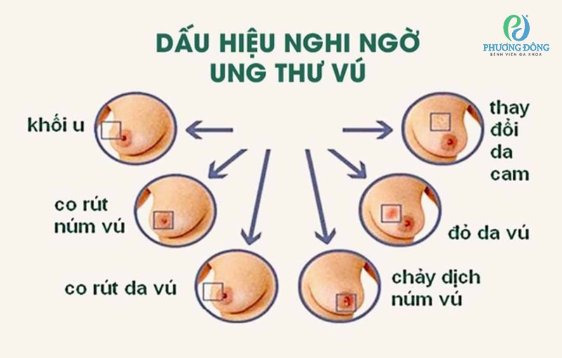đau ngực là dấu hiệu gì - Image 3