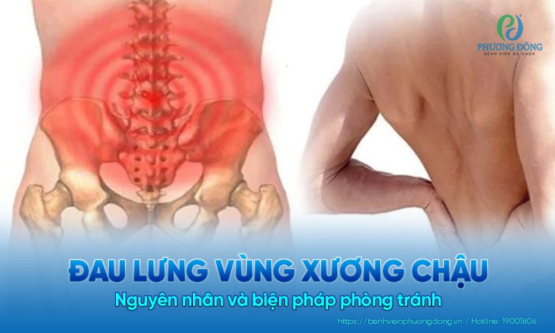 đau vùng chậu sau lưng - Image 4