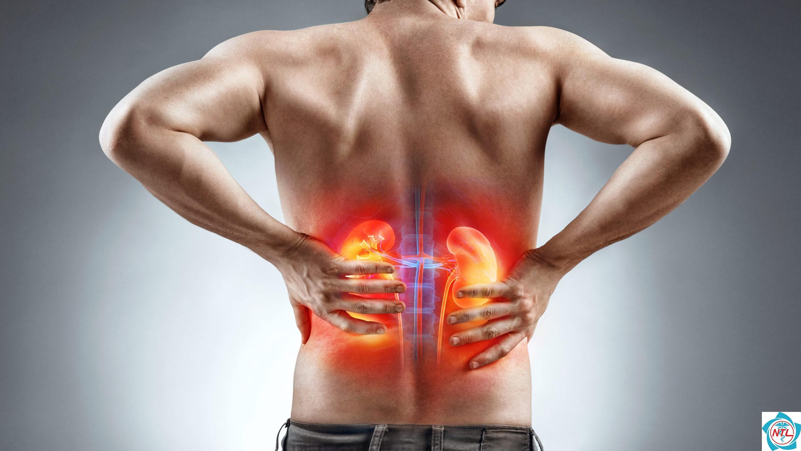 đau vùng thận - Image 1