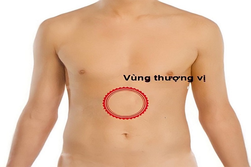 đau vùng thượng vị kéo dài - Image 4