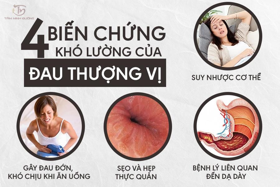 đau vùng thượng vị kéo dài - Image 5