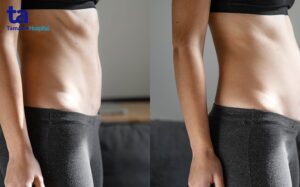 đầy bụng là dấu hiệu bệnh gì