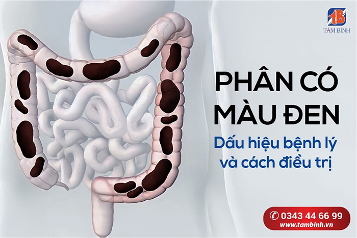 đi ngoài phân đen là bệnh gì - Image 5