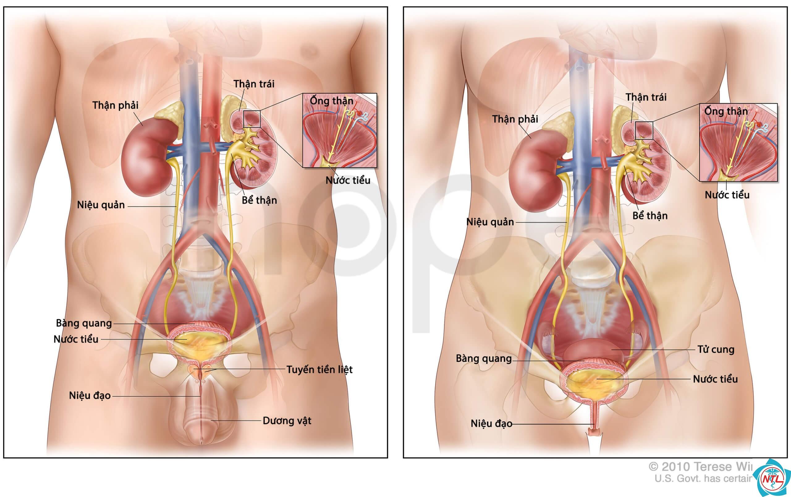 dị tật thận bẩm sinh - Image 4