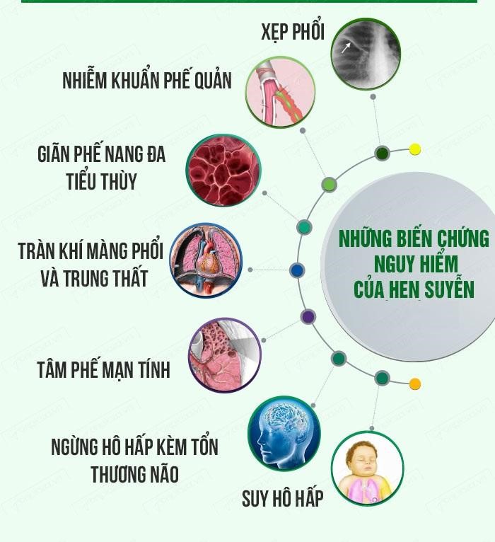điều trị hen phế quản - Image 5