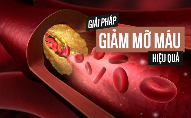 điều trị mỡ máu cao - Image 5
