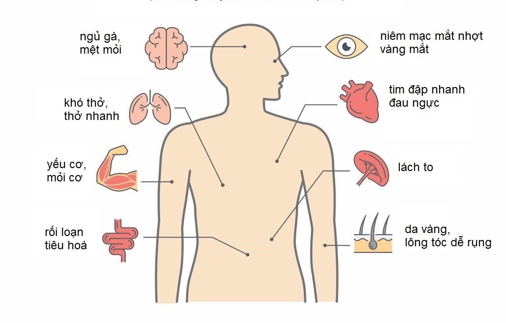 điều trị thiếu máu - Image 2