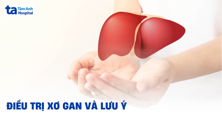 điều trị xơ gan - Image 4