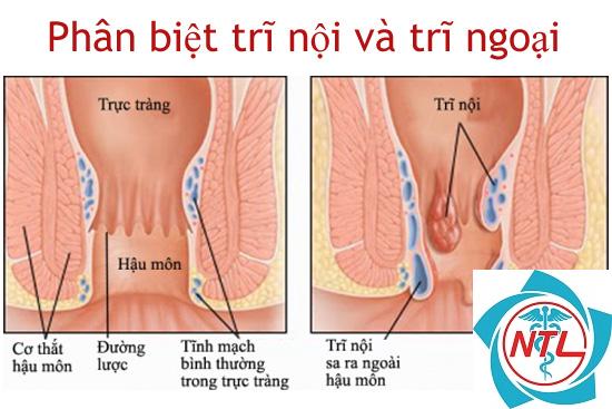 đường lược là gì - Image 3