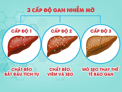 gan nhiễm mỡ là gì - Image 1