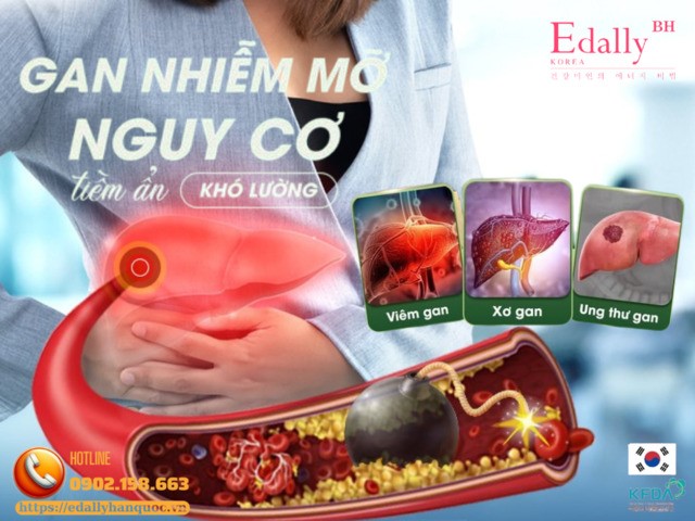gan nhiễm mỡ ở người tiểu đường - Image 5