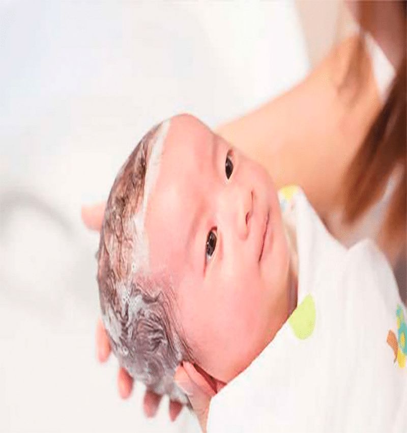 gàu ở trẻ em - Image 5