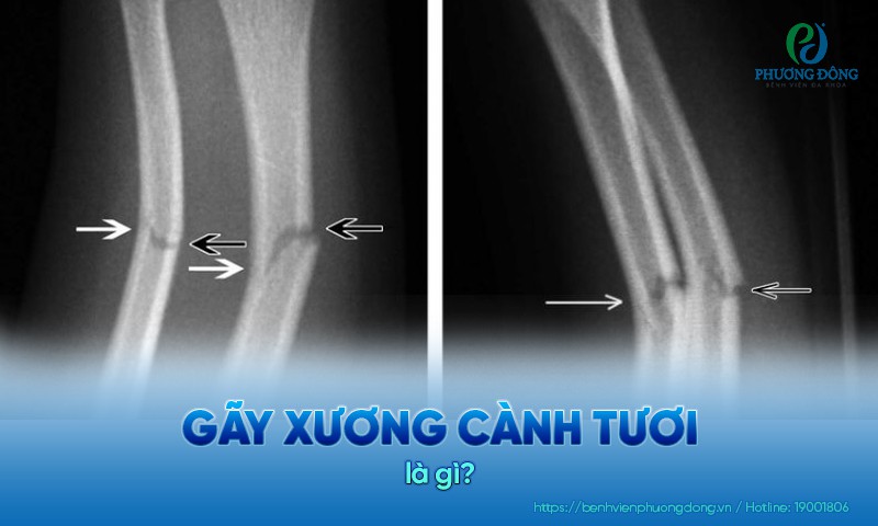 gãy cành tươi - Image 2