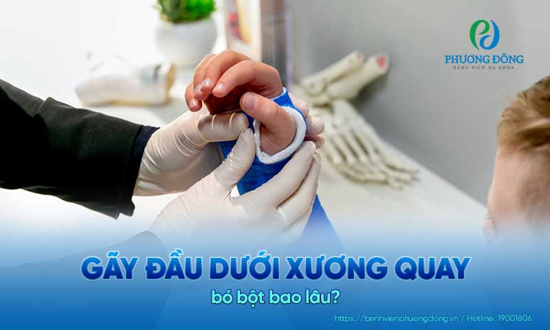 gãy đầu dưới xương quay bó bột bao lâu - Image 4