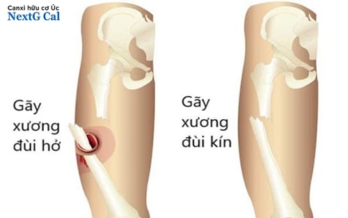 gay kín - Image 3