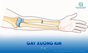 gay kín
