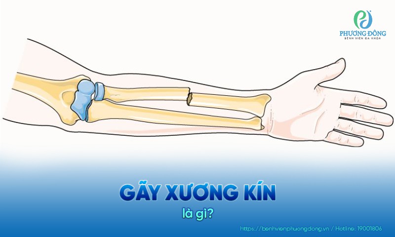 gay kín