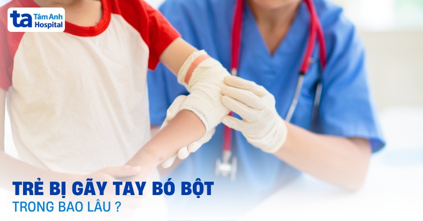 gãy tay bó bột bao lâu thì tháo - Image 2