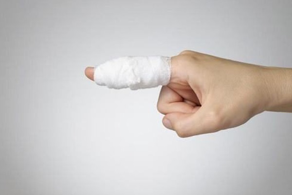 gãy tay thương tích bao nhiêu phần trăm - Image 4