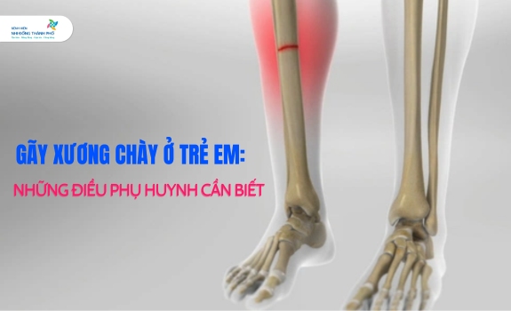 gãy xương cẳng chân ở trẻ em - Image 2