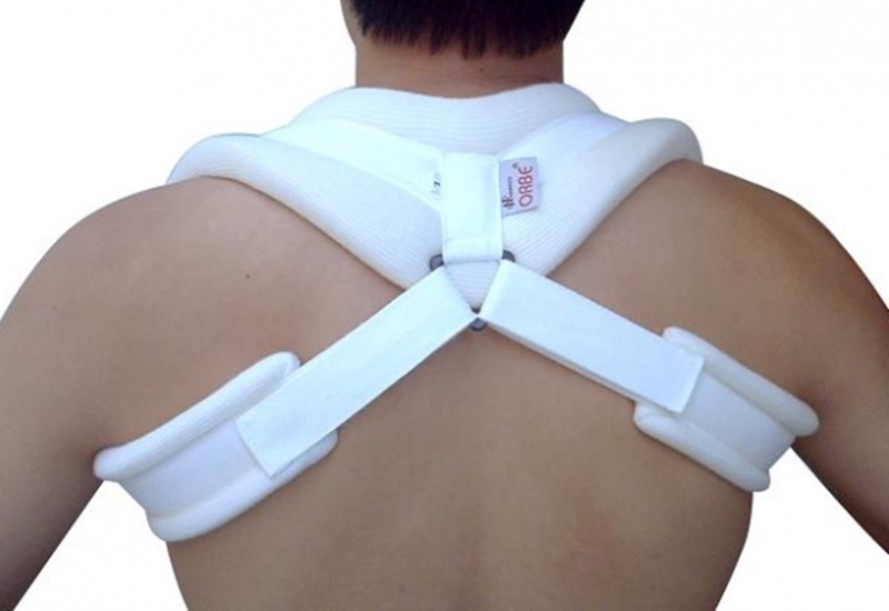 gãy xương đòn có cần bó bột không - Image 2