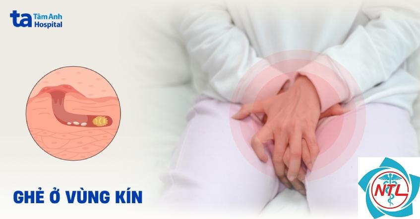 ghẻ ở bộ phận sinh dục