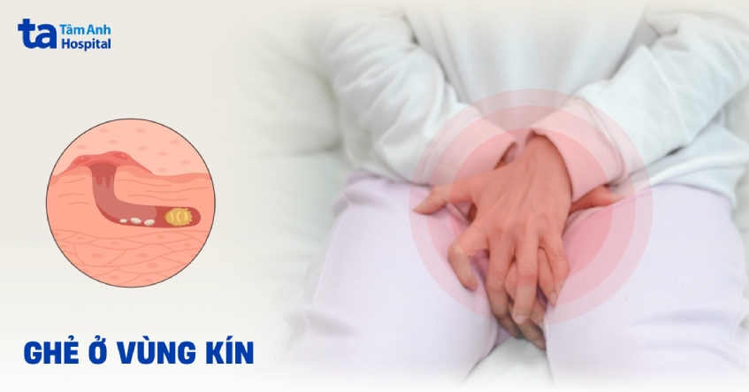 ghẻ ở vùng sinh dục