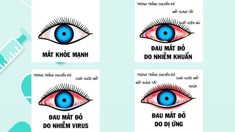 ghèn mắt là gì - Image 2