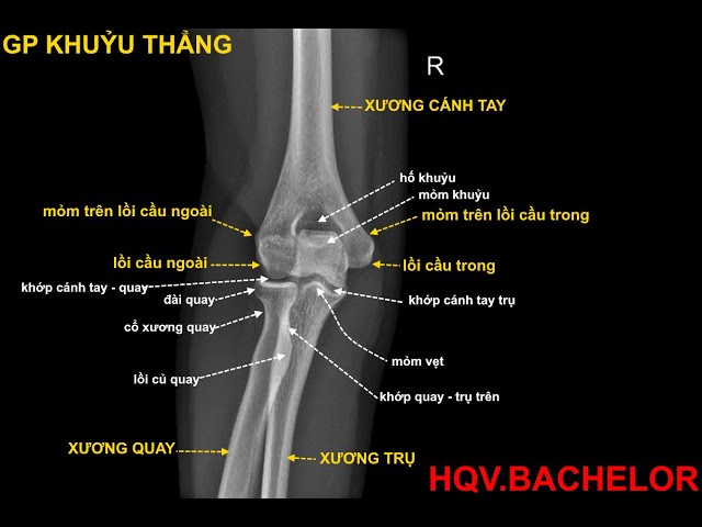 giải phẫu xương khuỷu tay - Image 3
