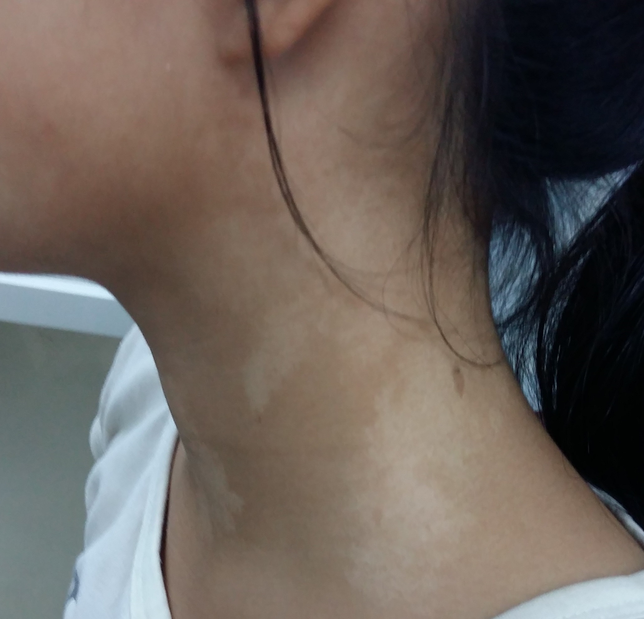 giảm sắc tố da - Image 5