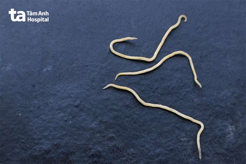 giun kim - Image 2