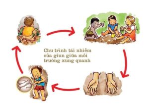 giun kim ở trẻ