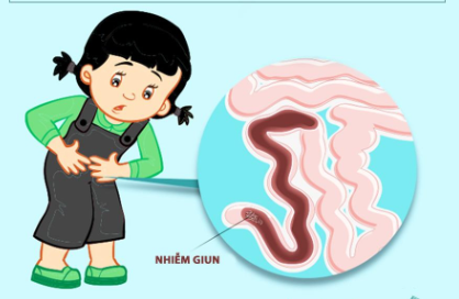 giun sán ở trẻ em