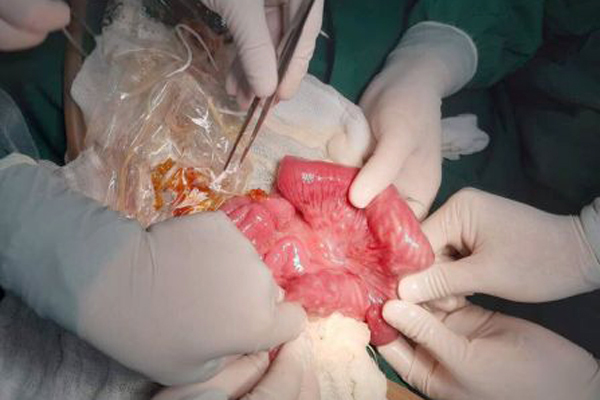 giun trong bụng bé 3 tuổi - Image 2