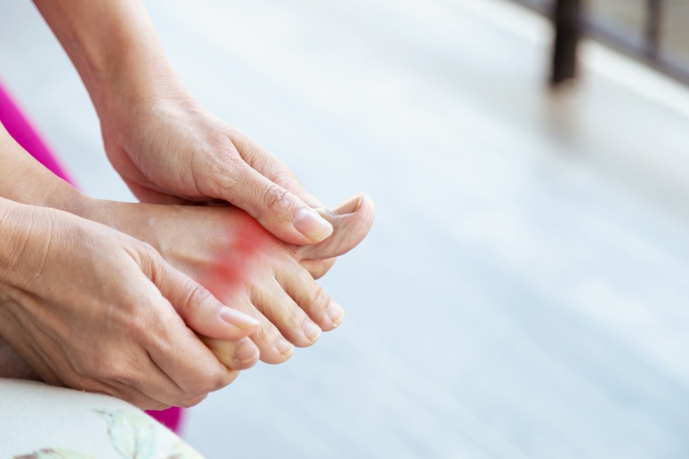 gout kèm tăng huyết áp - Image 2