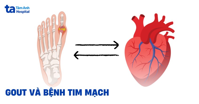 gout kèm tăng huyết áp - Image 5