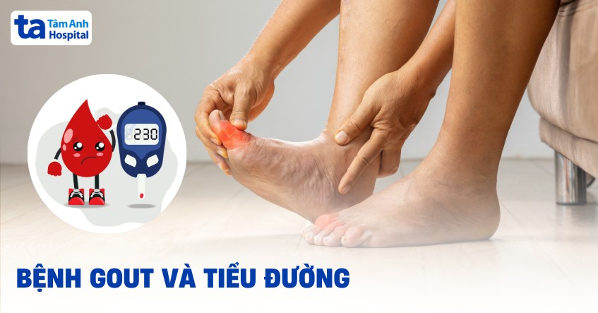 gout kèm tiểu đường - Image 1