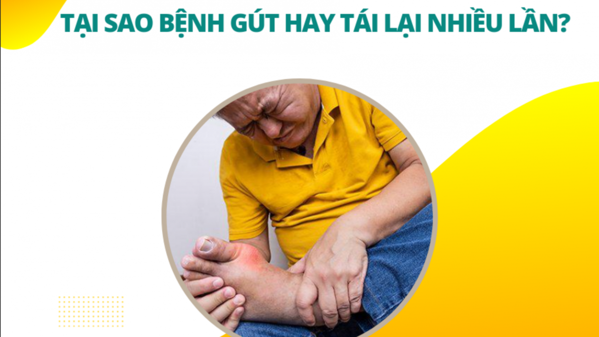 gout tái phát nhiều lần - Image 3