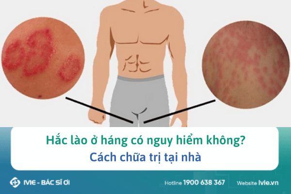 hắc lào ở bẹn - Image 5