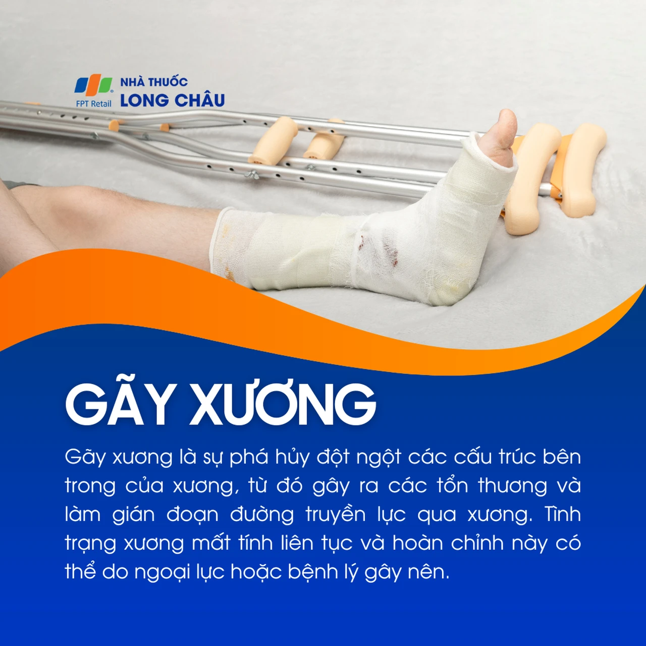 hãy nêu những nguyên nhân dẫn tới gãy xương - Image 4