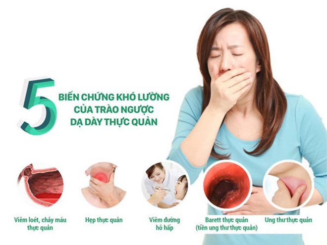 hen phế quản và trào ngược dạ dày - Image 4