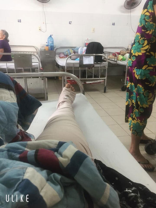 hình ảnh gãy chân nằm viện - Image 3