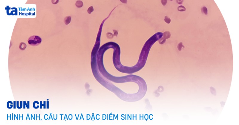 hình ảnh giun chỉ - Image 4
