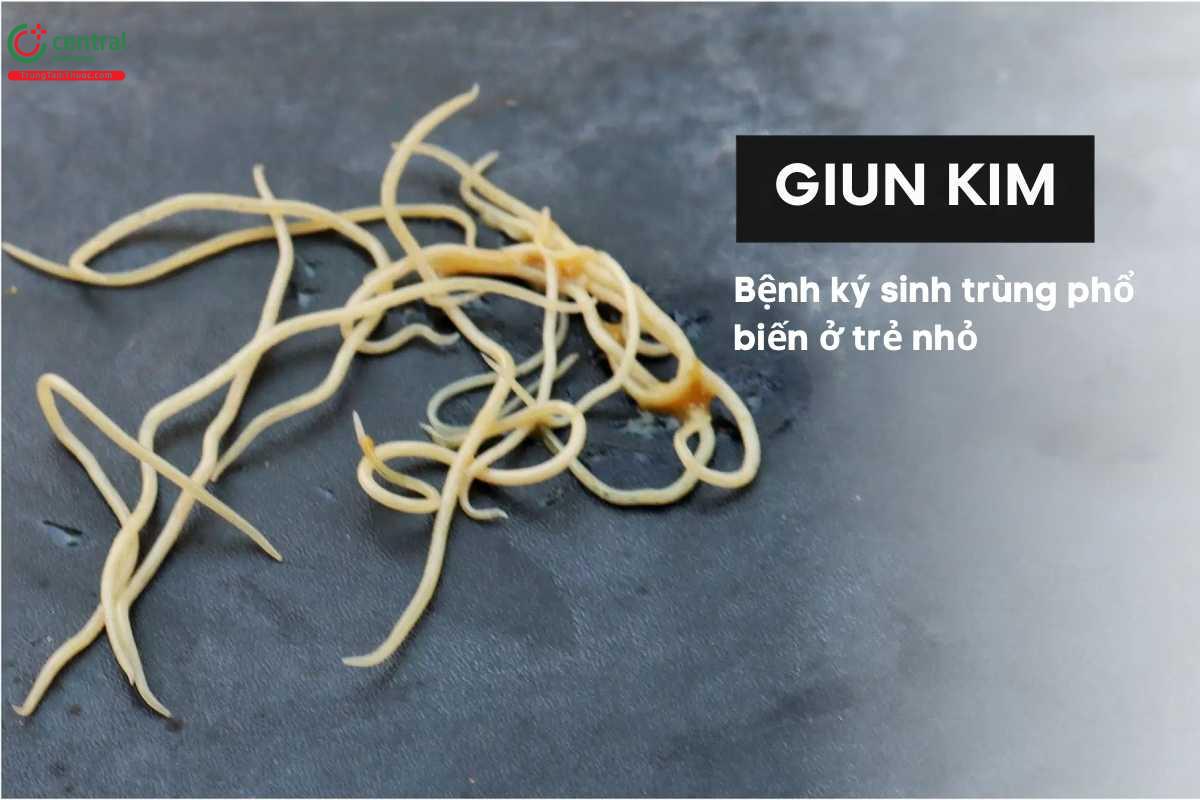 hình ảnh giun kim - Image 5