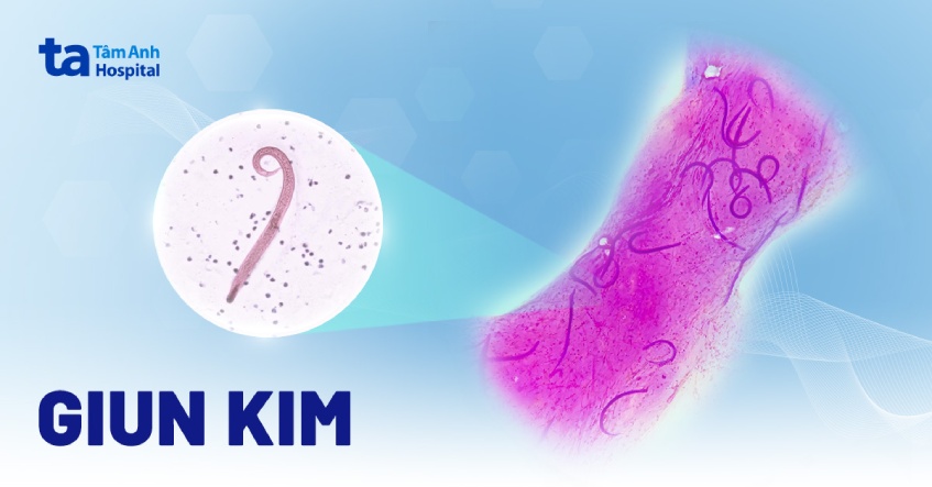 hình ảnh giun kim
